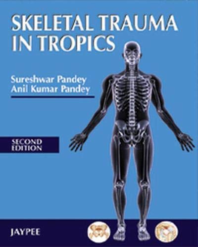 SKELETAL TRAUMA IN TROPICS - Retail Maharaj
