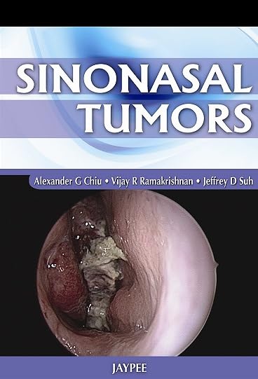 SINONASAL TUMORS - Retail Maharaj