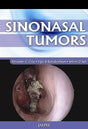 SINONASAL TUMORS - Retail Maharaj