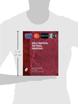 Multimodal Retinal Imaging - Retail Maharaj