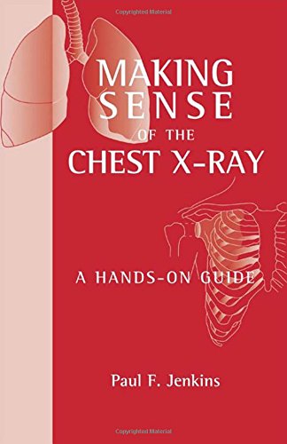 (OLD)MAKING SENSE OF THE CHEST X-RAY : A HANDS-ON GUIDE(ORG) - Retail Maharaj