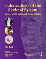 Tuberculosis of the Skeletal System (Bones, Joints, Spine and Bursal Sheaths) - Retail Maharaj