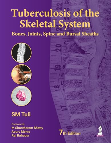 Tuberculosis of the Skeletal System (Bones, Joints, Spine and Bursal Sheaths) - Retail Maharaj
