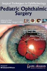 Pediatric Ophthalmic Surgery Surgical Techniques In Ophthalmology - Retail Maharaj