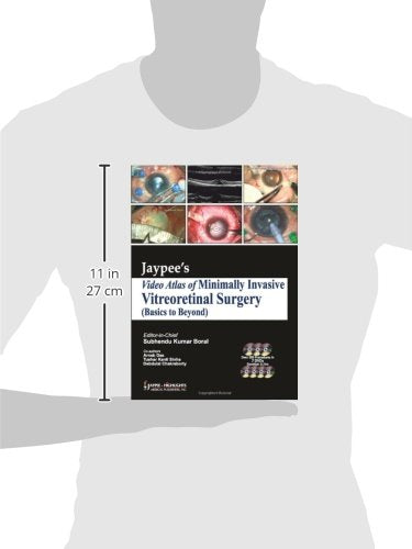Jaypee Video Atlas Of Minimally Invasive Vitreoretinal Surgery - Retail Maharaj