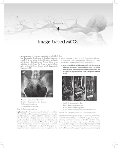 MCQs in Pain Medicine, 2/e | Over 2100 MCQs (PB 2026) - Retail Maharaj