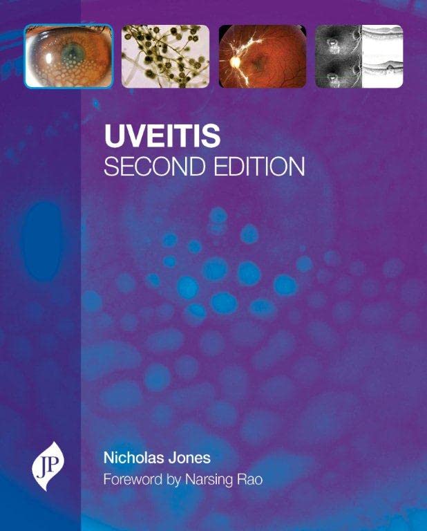 Uveitis with CD-ROM - Retail Maharaj