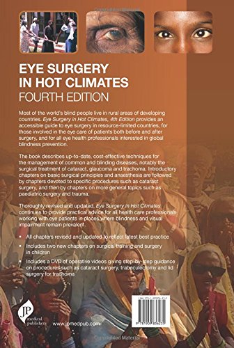 Eye Surgery in Hot Climates - Retail Maharaj