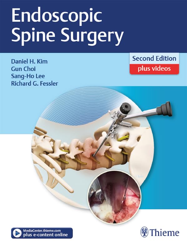 Endoscopic Spine Surgery - Retail Maharaj