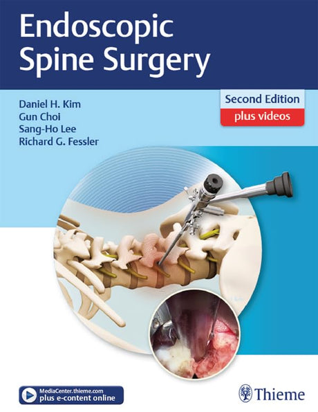 Endoscopic Spine Surgery - Retail Maharaj