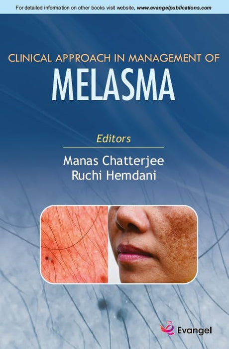 Clinical Approach in Management of MELASMA - Retail Maharaj