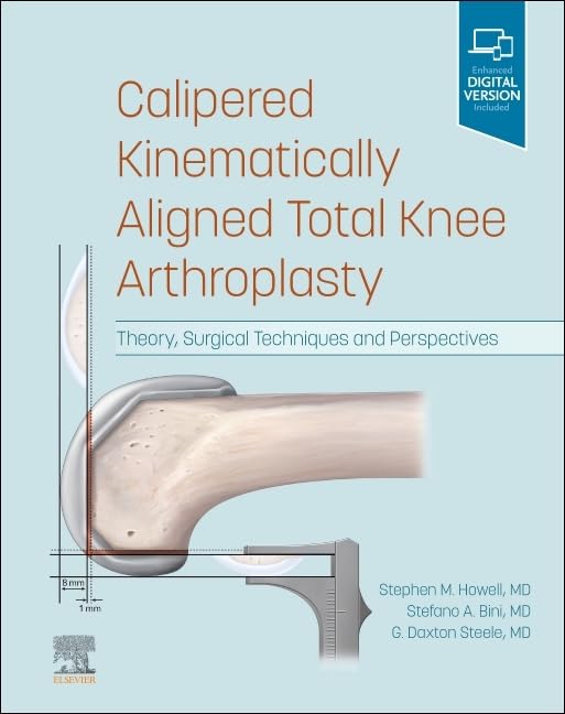 Calipered Kinematically aligned Total Knee Arthroplasty - Retail Maharaj