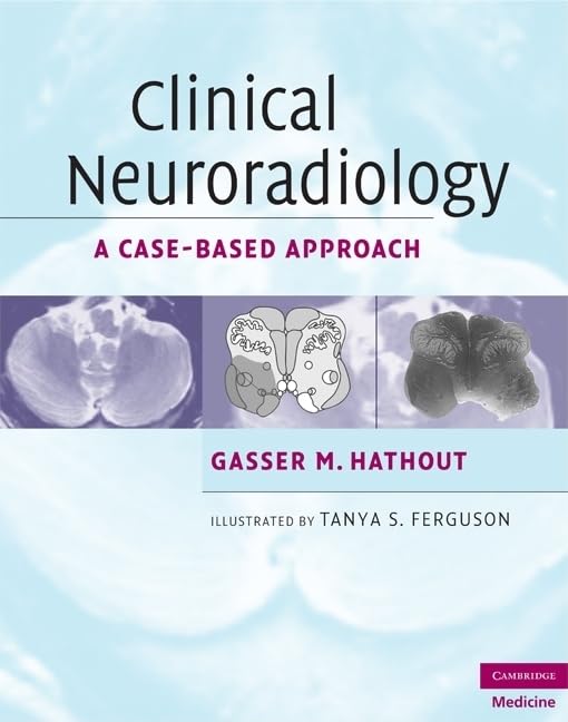 Clinical Neuroradiology: A Case-Based Approach (Cambridge Medicine (Hardcover)) - Retail Maharaj