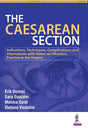 The Caesarean Section - Retail Maharaj