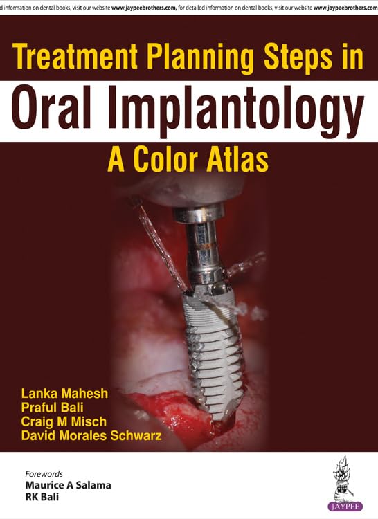 TREATMENT PLANNING STEPS IN ORAL IMPLANTOLOGY:A COLOR ATLAS - Retail Maharaj