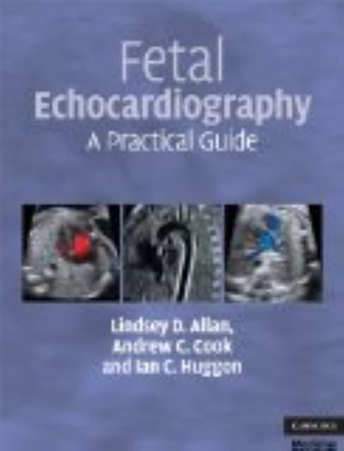 Fetal Echocardiography: A Practical Guide - Retail Maharaj