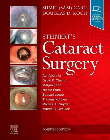 Steinert's Cataract Surgery - Retail Maharaj