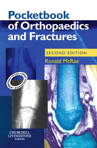 Pocketbook of Orthopaedics and Fractures (Old Edition) - Retail Maharaj