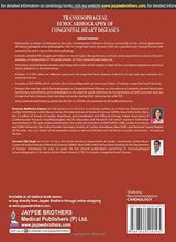 TRANSESOPHAGEAL ECHOCARDIOGRAPHY OF CONGENITAL HEART DISEASES - Retail Maharaj
