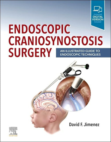 Endoscopic Craniosynostosis Surgery: An Illustrated Guide to Endoscopic Techniques - 1E - Retail Maharaj