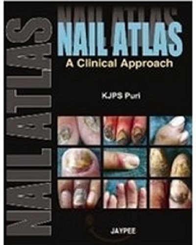 Nail Atlas: A Clinical Approach - Retail Maharaj