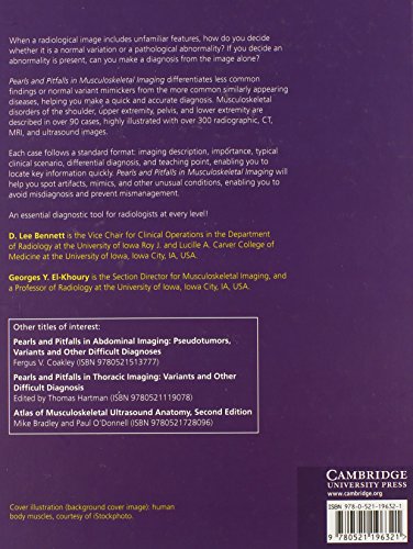 Pearls and Pitfalls in Musculoskeletal Imaging: Variants and Other Difficult Diagnoses - Retail Maharaj