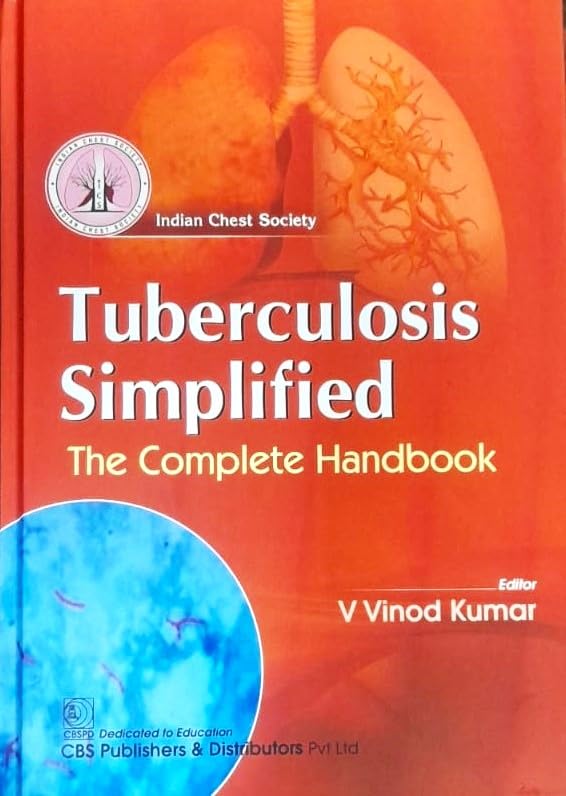 Tuberculosis Simplified The Complete Handbook (Hb 2024) - Retail Maharaj