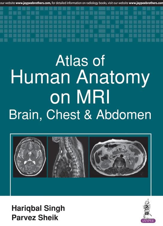 ATLAS OF HUMAN ANATOMY ON MRI:BRAIN, CHEST & ABDOMEN - Retail Maharaj