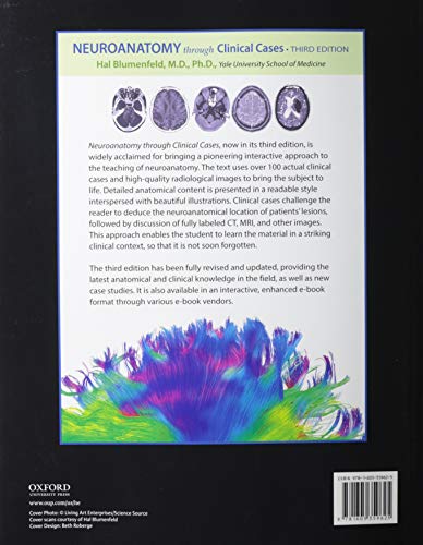 Neuroanatomy through Clinical Cases - Retail Maharaj