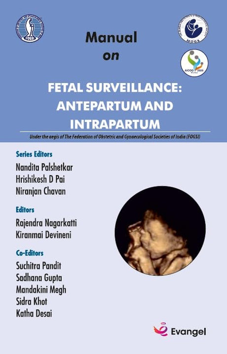 MANUAL ON FETAL SURVEILLANCE: ANTEPARTUM AND INTRAPARTUM - Retail Maharaj