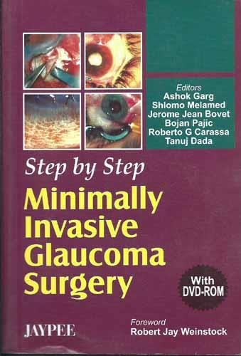 Step By Step Minimally invasive Glaucoma Surgery with DVD-ROM - Retail Maharaj