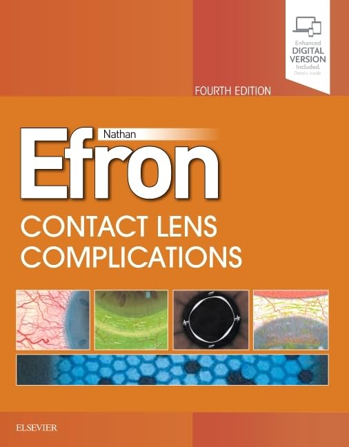 CONTACT LENS COMPLICATIONS WITH ACCESS CODE 4ED (HB 2019) - Retail Maharaj