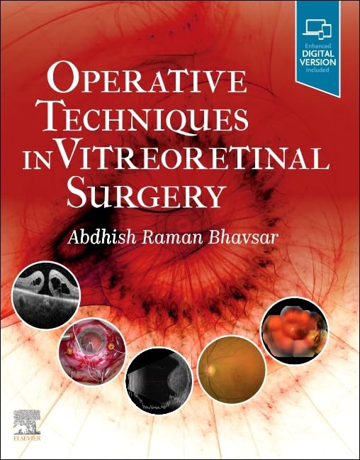 OPERATIVE TECHNIQUES IN VITREORETINAL SURGERY, 1ST EDITION - Retail Maharaj