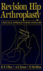 Revision Hip Arthroplasty: A Practical Approach to Bone Stock Loss - Retail Maharaj