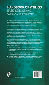 Handbook of Vitiligo - Retail Maharaj