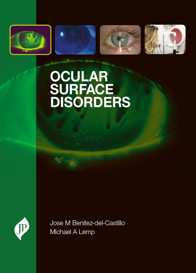 Ocular Surface Disorders - Retail Maharaj