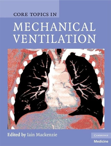Core Topics in Mechanical Ventilation (Cambridge Medicine (Hardcover)) - Retail Maharaj