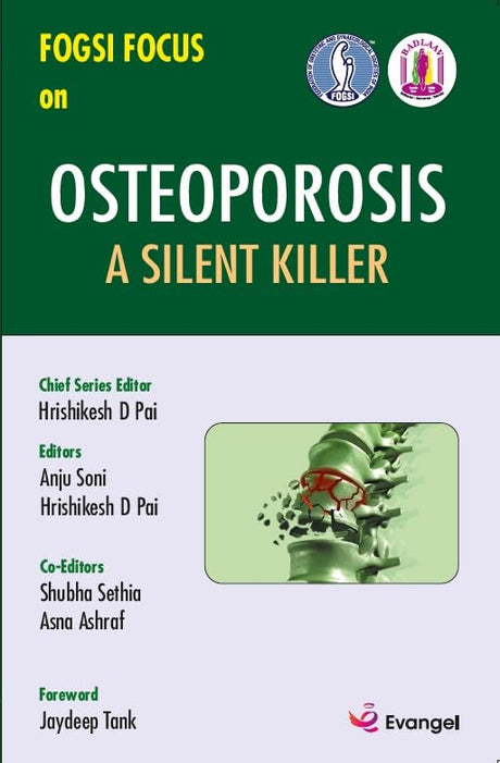 FOGSI FOCUS on Osteoporosis A Silent Killer - Retail Maharaj