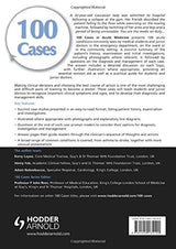 100 Cases in Acute Medicine - Retail Maharaj