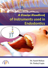 A Concise Handbook of Instruments used in Endodontics - Retail Maharaj