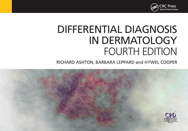 DIFFERENTIAL DIAGNOSIS IN DERMATOLOGY (EX) - Retail Maharaj
