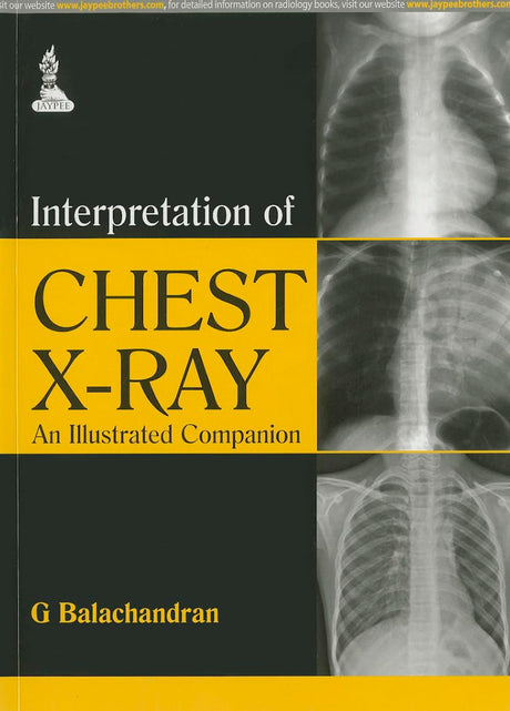 Interpretation of Chest X-ray: An Illustrated Companion - Retail Maharaj
