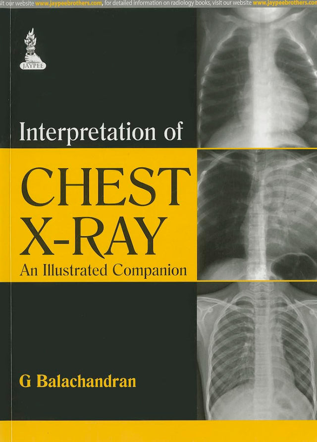 Interpretation of Chest X-ray: An Illustrated Companion - Retail Maharaj