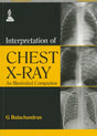 Interpretation of Chest X-ray: An Illustrated Companion - Retail Maharaj
