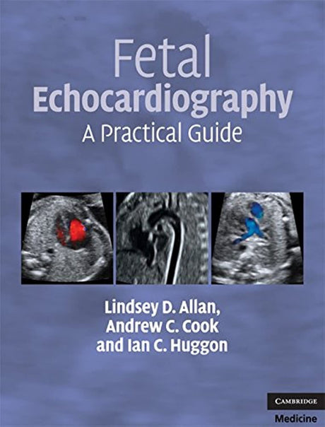 Fetal Echocardiography: A Practical Guide - Retail Maharaj