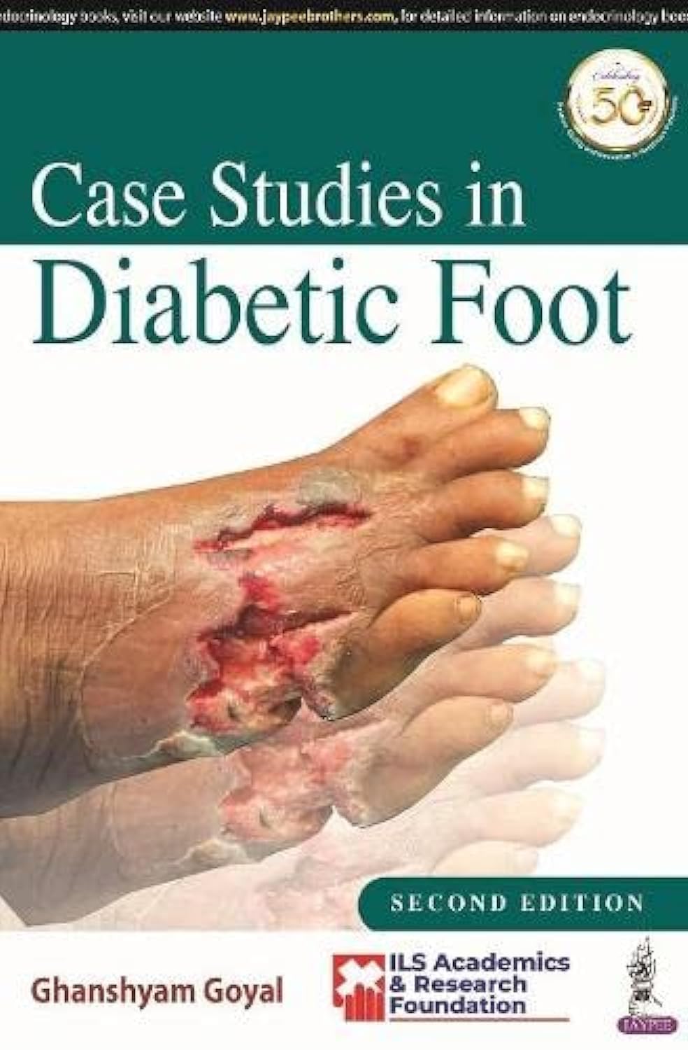 CASE STUDIES IN DIABETIC FOOT - Retail Maharaj