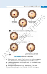SIMPLIFIED PHACOEMULSIFICATION - Retail Maharaj