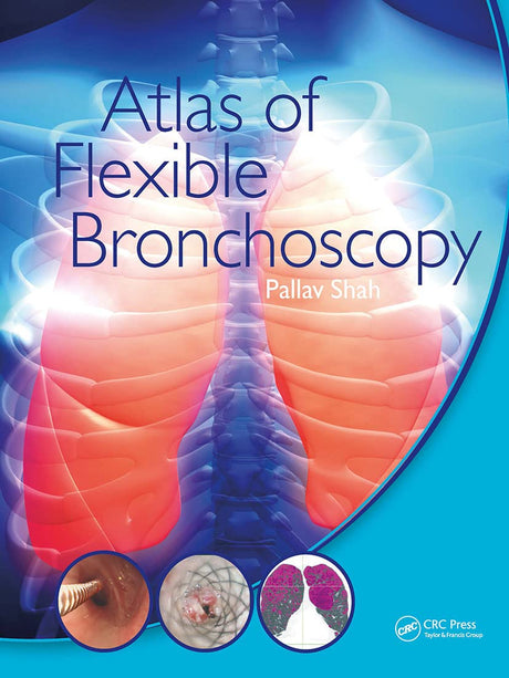 Atlas of Flexible Bronchoscopy - Retail Maharaj