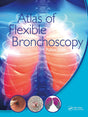 Atlas of Flexible Bronchoscopy - Retail Maharaj
