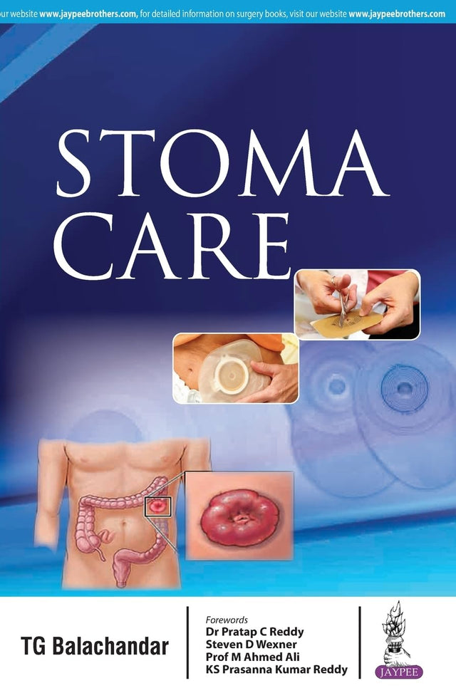 STOMA CARE - Retail Maharaj